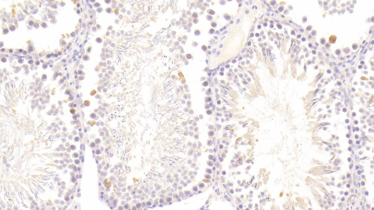 Immunohistochemistry-Paraffin Glutathione Peroxidase 5 Antibody