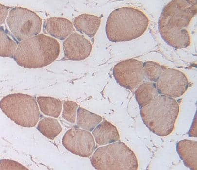 Immunohistochemistry-Paraffin: Triadin Antibody [NBP3-41834] - Used in DAB staining on fromalin fixed paraffin- embedded skeletal muscle tissue