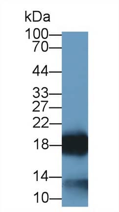 Western Blot: Eosinophil derived neurotoxin Antibody (C1) [NBP3-41839] - Sample: Lane1: Human Urine; Lane2: Human Leukocyte lysate Primary Ab: 2ug/ml NBP3-41839; Second Ab: 0.2ug/mL HRP-Linked Caprine Anti-Mouse IgG Polyclonal Antibody