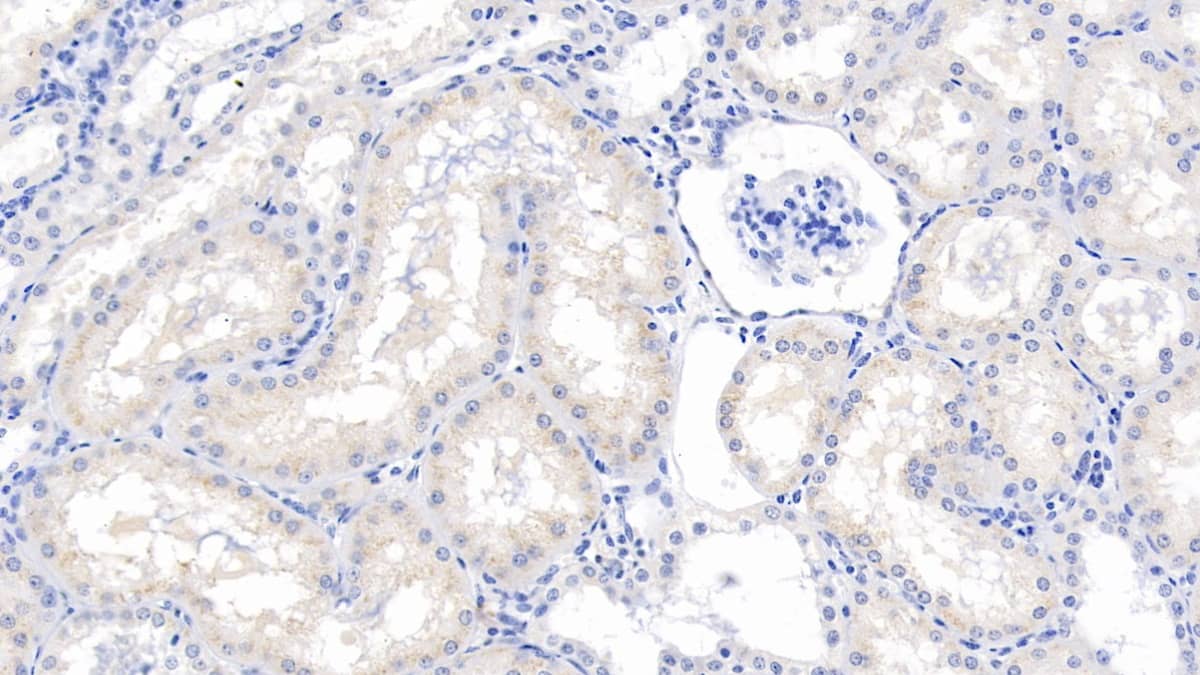 Immunohistochemistry-Paraffin: Eosinophil derived neurotoxin Antibody (C9) [NBP3-41840] - DAB staining on IHC-P; Sample: Human Kidney Tissue; Primary Ab: 10ug/ml NBP3-41840; Second Ab: 2ug/mL HRP-Linked Caprine Anti-Mouse IgG Polyclonal Antibody