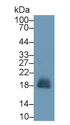 Western Blot: Eosinophil derived neurotoxin Antibody (C9) [NBP3-41840] - Sample: Human Urine Primary Ab: 2ug/ml NBP3-41840; Second Ab: 0.2ug/mL HRP-Linked Caprine Anti-Mouse IgG Polyclonal Antibody