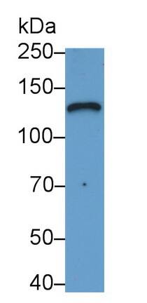 Western Blot: LAMC2 Antibody (D1) [NBP3-41842] - Sample: A431 cell lysate Primary Ab: 2ug/ml NBP3-41842; Second Ab: 0.2ug/mL HRP-Linked Caprine Anti-Mouse IgG Polyclonal Antibody