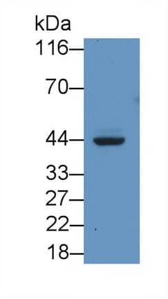 Western Blot: HLA C Antibody (C21) [NBP3-41843] - Sample: Hela cell lysate Primary Ab: 2ug/ml NBP3-41843; Second Ab: 0.2ug/mL HRP-Linked Caprine Anti-Mouse IgG Polyclonal Antibody