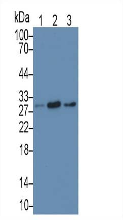 Western Blot: MAPRE1 Antibody (C8) [NBP3-41844] - Sample: Lane1: Hela cell lysate; Lane2: Jurkat cell lysate; Lane3: A431 cell lysate Primary Ab: 3ug/ml NBP3-41844; Second Ab: 0.2ug/mL HRP-Linked Caprine Anti-Mouse IgG Polyclonal Antibody