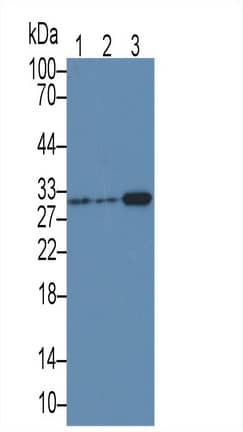 Western Blot: MAPRE1 Antibody (C9) [NBP3-41845] - Sample: Lane1: Rat Thymus lysate; Lane2: Hela cell lysate; Lane3: Jurkat cell lysate Primary Ab: 3ug/ml NBP3-41845; Second Ab: 0.2ug/mL HRP-Linked Caprine Anti-Mouse IgG Polyclonal Antibody