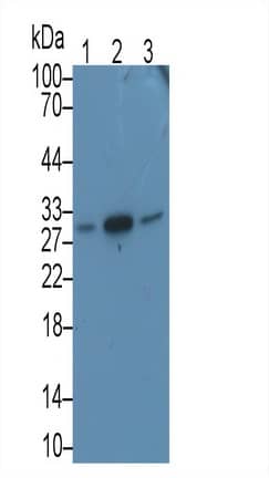 Western Blot: MAPRE1 Antibody (C7) [NBP3-41846] - Sample: Lane1: Hela cell lysate; Lane2: Jurkat cell lysate; Lane3: A431 cell lysate Primary Ab: 3ug/ml NBP3-41846; Second Ab: 0.2ug/mL HRP-Linked Caprine Anti-Mouse IgG Polyclonal Antibody