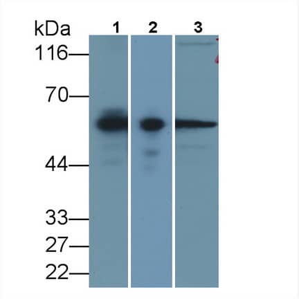 Western Blot: Calponin 2 Antibody (C6) [NBP3-41850] - Sample: Lane1: Human Lung lysate; Lane2: Porcine Lymph node lysate; Lane3: HepG2 cell lysate Primary Ab: 2ug/ml NBP3-41850; Second Ab: 0.2ug/mL HRP-Linked Caprine Anti-Mouse IgG Polyclonal Antibody