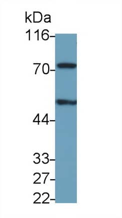 Western Blot PADI6 Antibody (D3) - BSA Free