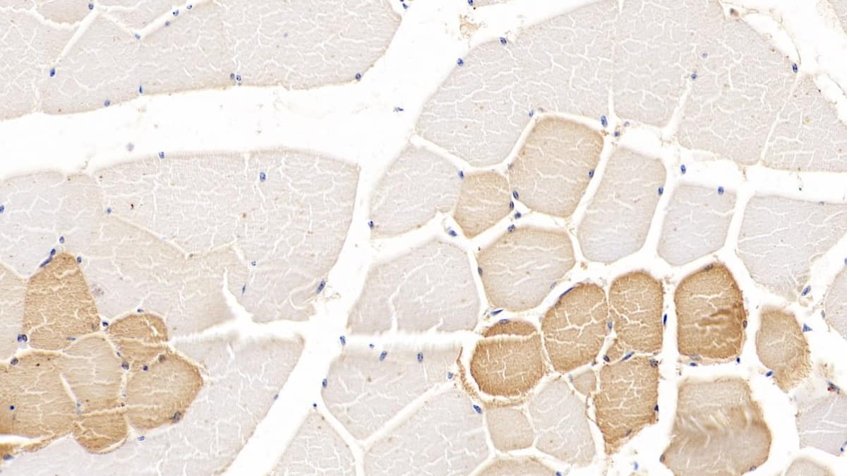 Immunohistochemistry-Paraffin: TDO2 Antibody (C2) [NBP3-41854] - DAB staining on IHC-P; Sample: Human Skeletal muscle Tissue; Primary Ab: 10ug/ml NBP3-41854; Second Ab: 2ug/mL HRP-Linked Caprine Anti-Mouse IgG Polyclonal Antibody