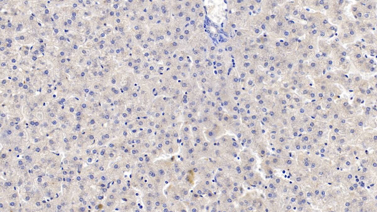 Immunohistochemistry-Paraffin: TDO2 Antibody (C2) [NBP3-41854] - DAB staining on IHC-P; Sample: Human Liver Tissue; Primary Ab: 10ug/ml NBP3-41854; Second Ab: 2ug/mL HRP-Linked Caprine Anti-Mouse IgG Polyclonal Antibody