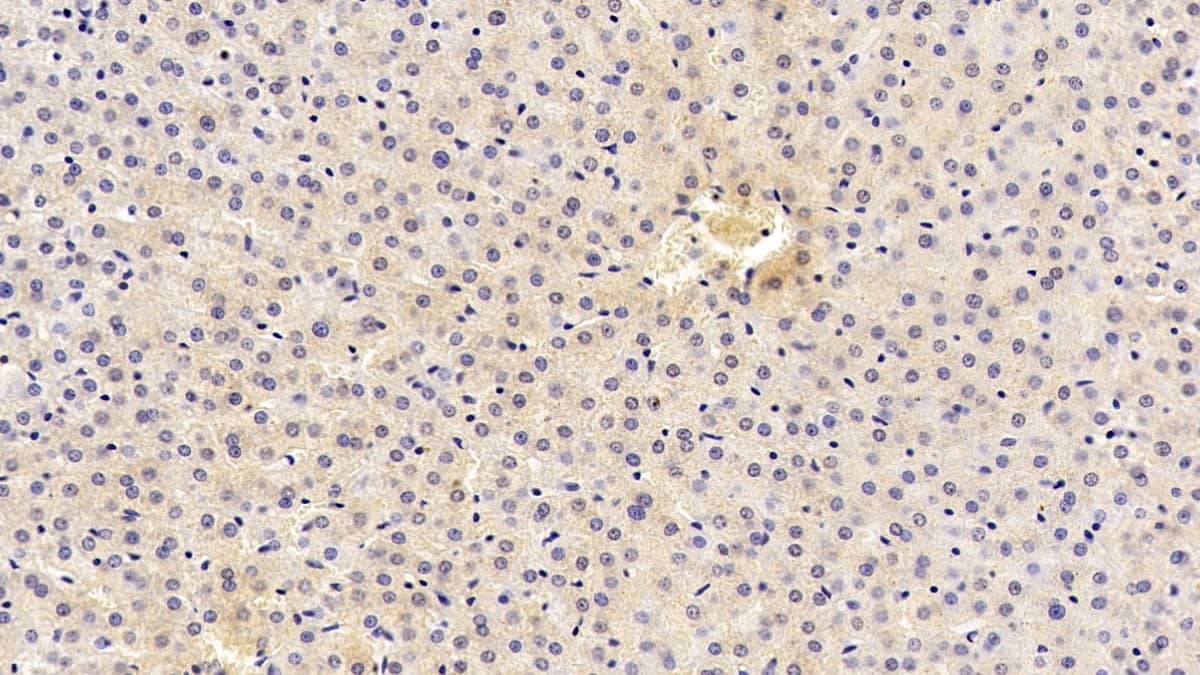 Immunohistochemistry-Paraffin: CMG-2/ANTXR2 Antibody (C1) [NBP3-41856] - DAB staining on IHC-P; Sample: Human Liver Tissue; Primary Ab: 30ug/ml NBP3-41856; Second Ab: 2ug/mL HRP-Linked Caprine Anti-Mouse IgG Polyclonal Antibody