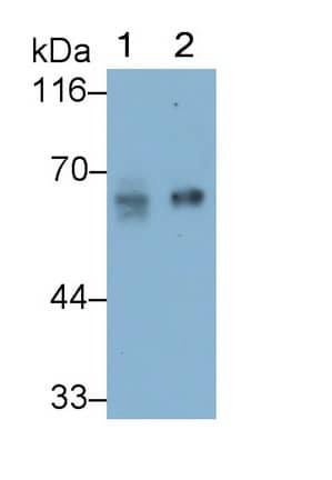 Western Blot: PSAP Antibody (D8) [NBP3-41857] - Sample: Lane1: 293T cell lysate; Lane2: A431 cell lysate Primary Ab: 0.8ug/ml NBP3-41857; Second Ab: 0.2ug/mL HRP-Linked Caprine Anti-Mouse IgG Polyclonal Antibody