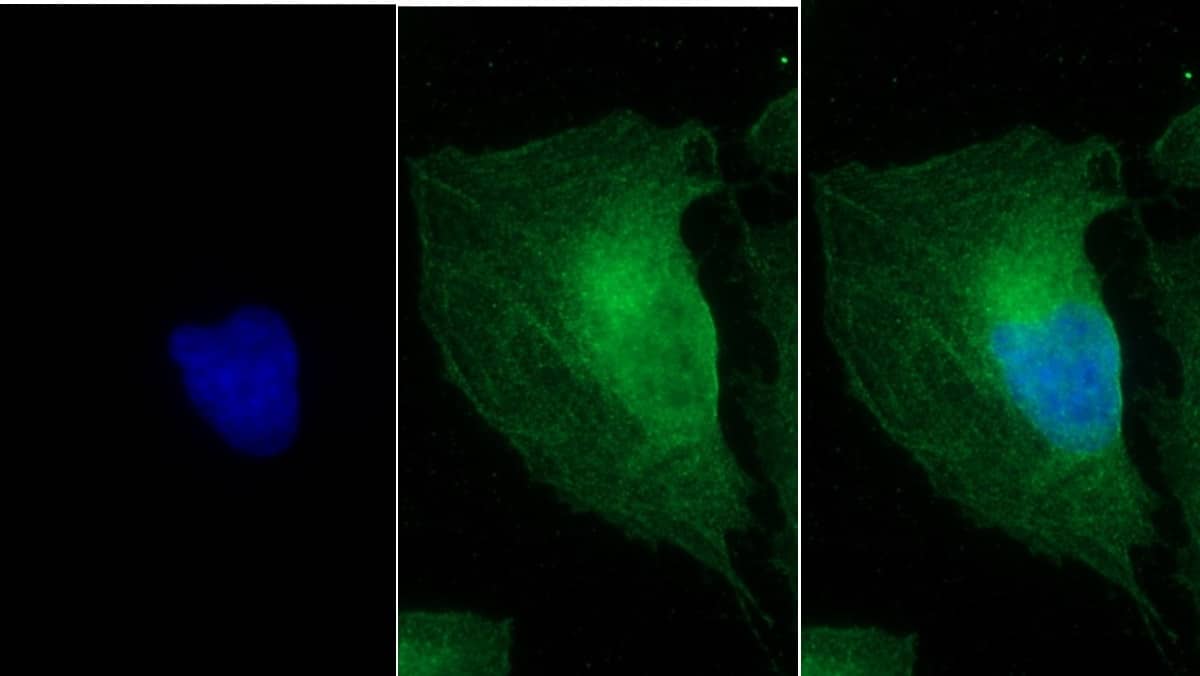 Immunocytochemistry /Immunofluorescence: MYH8 Antibody (C1) [NBP3-41858] - FITC staining on IF; Sample: Human U2OS cell; Primary Ab: 30ug/ml NBP3-41858; Second Ab: 2ug/ml FITC-Linked Caprine Anti-Mouse IgG Polyclonal Antibody