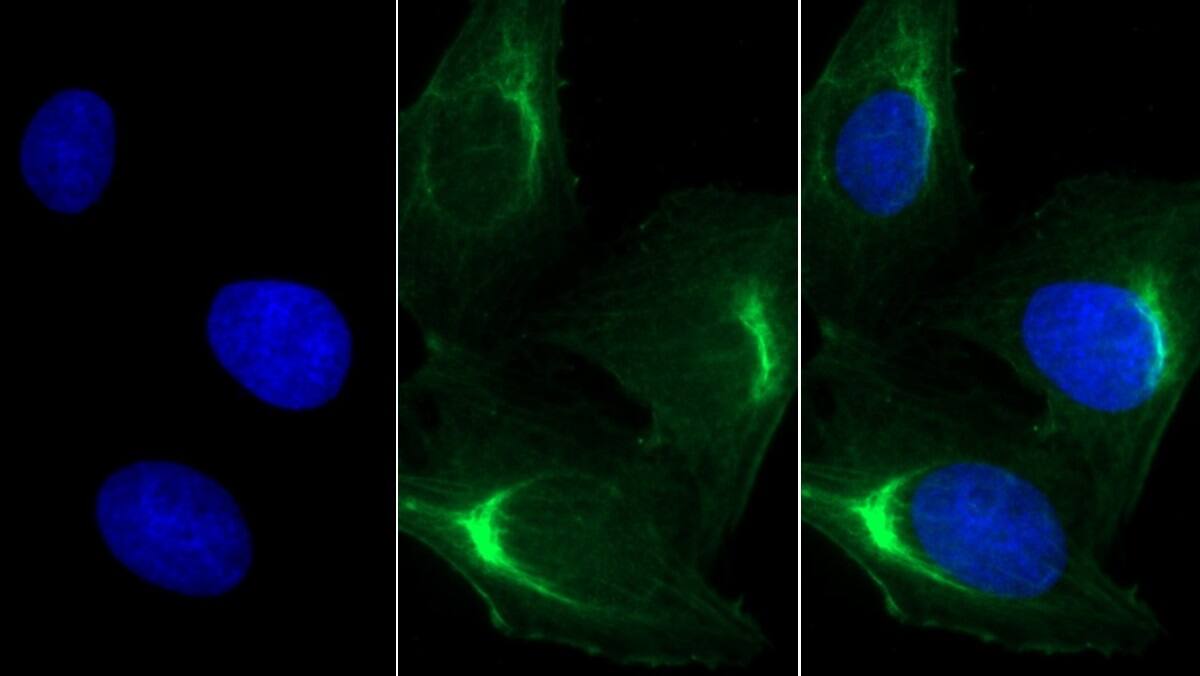 Immunocytochemistry /Immunofluorescence: MYH8 Antibody (C3) [NBP3-41859] - FITC staining on IF; Sample: Human U2OS cell; Primary Ab: 30ug/ml NBP3-41859; Second Ab: 2ug/ml FITC-Linked Caprine Anti-Mouse IgG Polyclonal Antibody