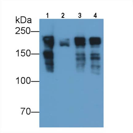 Western Blot: MYH8 Antibody (D1) [NBP3-41860] - Sample: Lane1: Rat Skeletal muscle lysate; Lane2: Mouse Skeletal muscle lysate Primary Ab: 0.01ug/ml NBP3-41860; Second Ab: 0.2ug/mL HRP-Linked Caprine Anti-Mouse IgG Polyclonal Antibody