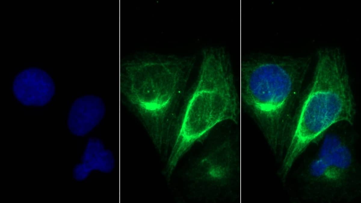 Immunocytochemistry/ Immunofluorescence MYH8 Antibody (D1)