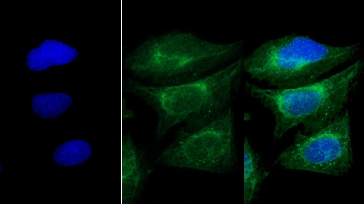 Immunocytochemistry /Immunofluorescence: MYH8 Antibody (D2) [NBP3-41861] - FITC staining on IF; Sample: Human U2OS cell; Primary Ab: 30ug/ml NBP3-41861; Second Ab: 2ug/ml FITC-Linked Caprine Anti-Mouse IgG Polyclonal Antibody