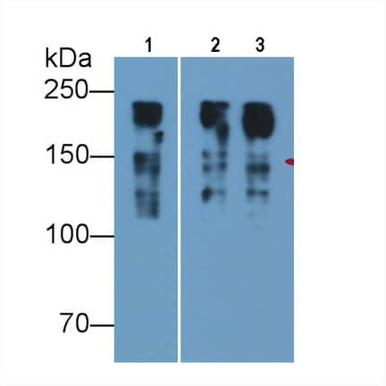 Western Blot: MYH8 Antibody (D2) [NBP3-41861] - Sample: Lane1: Porcine Skeletal muscle lysate; Lane2: Porcine Esophagus lysate; Lane3: Rat Skeletal muscle lysate; Lane4: Mouse Skeletal muscle lysate Primary Ab: 0.01ug/ml NBP3-41861; Second Ab: 0.2ug/mL HRP-Linked Caprine Anti-Mouse IgG Polyclonal Antibody