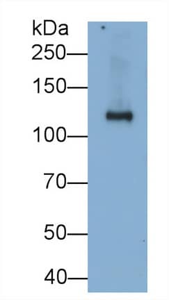 Western Blot: SI Sucrase-Isomaltase Antibody (C1) [NBP3-41862] - Sample: Rat Small intestine lysate Primary Ab: 0.2ug/ml NBP3-41862; Second Ab: 0.2ug/mL HRP-Linked Caprine Anti-Mouse IgG Polyclonal Antibody