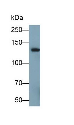 Western Blot: SI Sucrase-Isomaltase Antibody (C12) [NBP3-41863] - Sample: Rat Small intestine lysate Primary Ab: 0.5ug/ml NBP3-41863; Second Ab: 0.2ug/mL HRP-Linked Caprine Anti-Mouse IgG Polyclonal Antibody