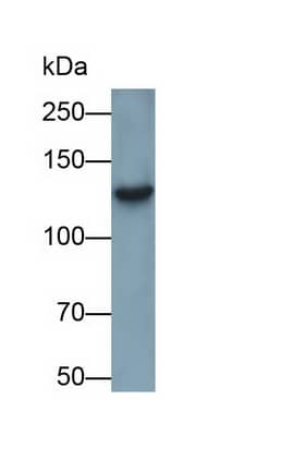 Western Blot: SI Sucrase-Isomaltase Antibody (C13) [NBP3-41864] - Sample: Rat Small intestine lysate Primary Ab: 0.5ug/ml NBP3-41864; Second Ab: 0.2ug/mL HRP-Linked Caprine Anti-Mouse IgG Polyclonal Antibody