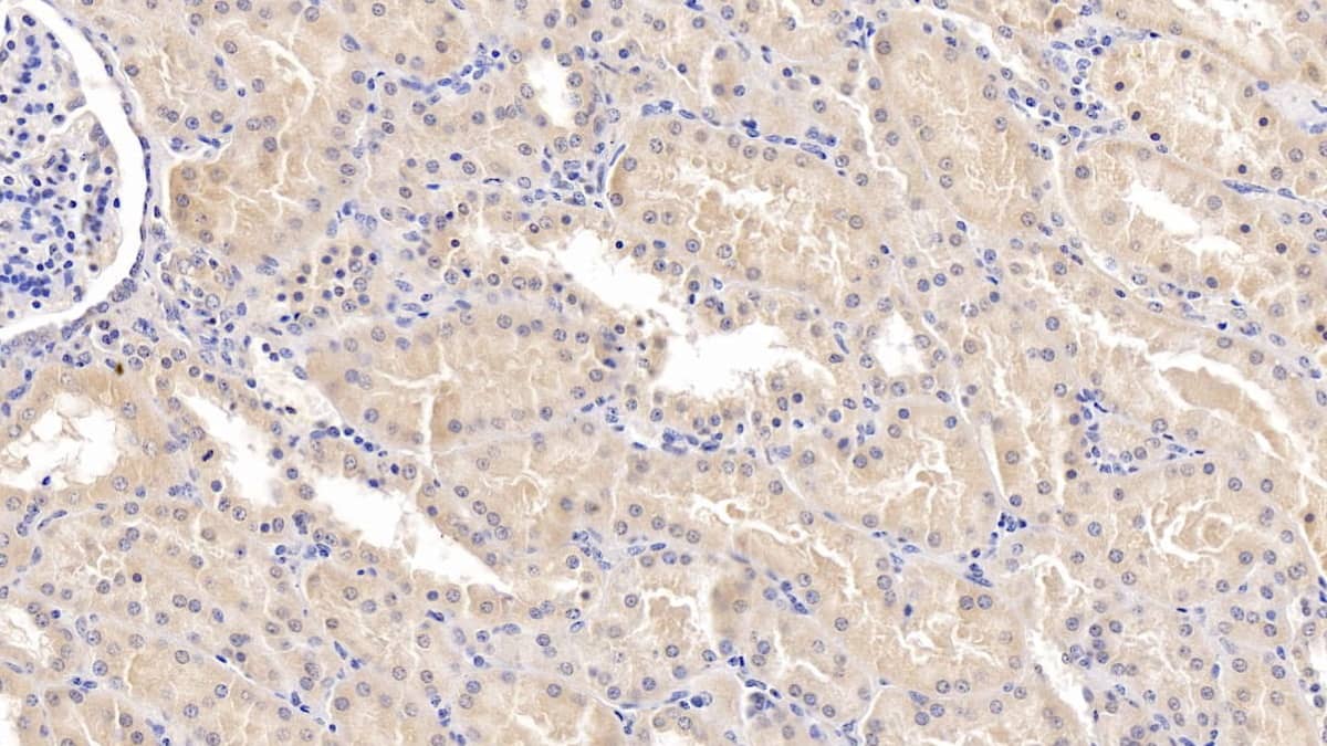 Immunohistochemistry-Paraffin MAPRE1 Antibody (C4)