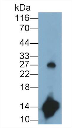 Western Blot: Cystatin S Antibody (C8) [NBP3-41867] - Sample: Human Saliva Primary Ab: 0.2ug/ml NBP3-41867; Second Ab: 0.2ug/mL HRP-Linked Caprine Anti-Mouse IgG Polyclonal Antibody