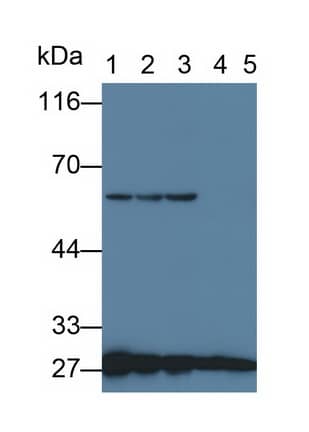 Western Blot: 14-3-3 zeta Antibody (C3) [NBP3-41868] - Sample: Lane1: Rat Cerebrum lysate; Lane2: Raji cell lysate; Lane3: 3T3-L1 cell lysate; Lane4: PC3 cell lysate; Lane5: Jurkat cell lysate Primary Ab: 0.2ug/ml NBP3-41868; Second Ab: 0.2ug/mL HRP-Linked Caprine Anti-Mouse IgG Polyclonal Antibody