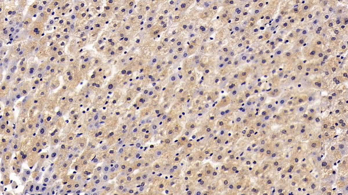 Immunohistochemistry-Paraffin: CMG-2/ANTXR2 Antibody (C2) [NBP3-41870] - DAB staining on IHC-P; Sample: Human Liver Tissue; Primary Ab: 30ug/ml NBP3-41870; Second Ab: 2ug/mL HRP-Linked Caprine Anti-Mouse IgG Polyclonal Antibody