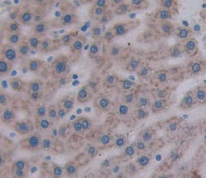 Immunohistochemistry-Paraffin MTIF2 Antibody - BSA Free