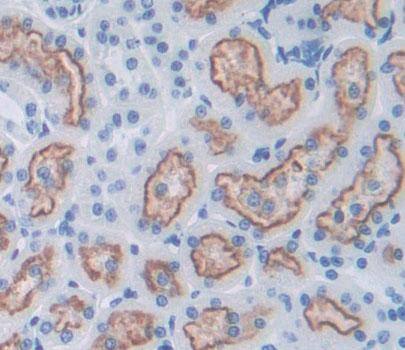 Immunohistochemistry-Paraffin: Surf1 Antibody [NBP3-41876] - Used in DAB staining on fromalin fixed paraffin- embedded kidney tissue