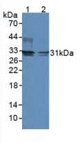 Western Blot: DIO2 Antibody [NBP3-41877] - Sample: Lane1: Rat Brain Tissue; Lane2: Mouse Brain Tissue.