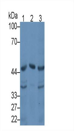 Western Blot: Serpin A10/ZPI Antibody (C6) [NBP3-41881] - Sample: Lane1: Rat Liver lysate; Lane2: Rat Ovary lysate; Lane3: HepG2 cell lysate Primary Ab: 3ug/ml NBP3-41881; Second Ab: 0.2ug/mL HRP-Linked Caprine Anti-Mouse IgG Polyclonal Antibody