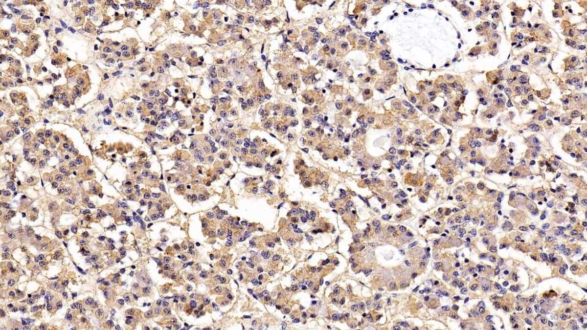 Immunohistochemistry-Paraffin: LH beta Antibody (H5) [NBP3-41882] - DAB staining on IHC-P; Sample: Porcine Pituitary Tissue; Primary Ab: 20ug/ml NBP3-41882; Second Ab: 2ug/mL HRP-Linked Caprine Anti-Mouse IgG Polyclonal Antibody