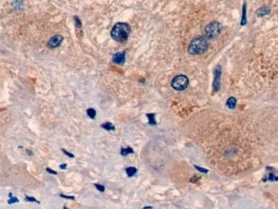 Immunohistochemistry-Paraffin: UCN2 Antibody (C7) [NBP3-41884] - DAB staining on IHC-P; Sample: Human Liver Tissue; Primary Ab: 20ug/ml NBP3-41884; Second Ab: 2ug/mL HRP-Linked Caprine Anti-Mouse IgG Polyclonal Antibody