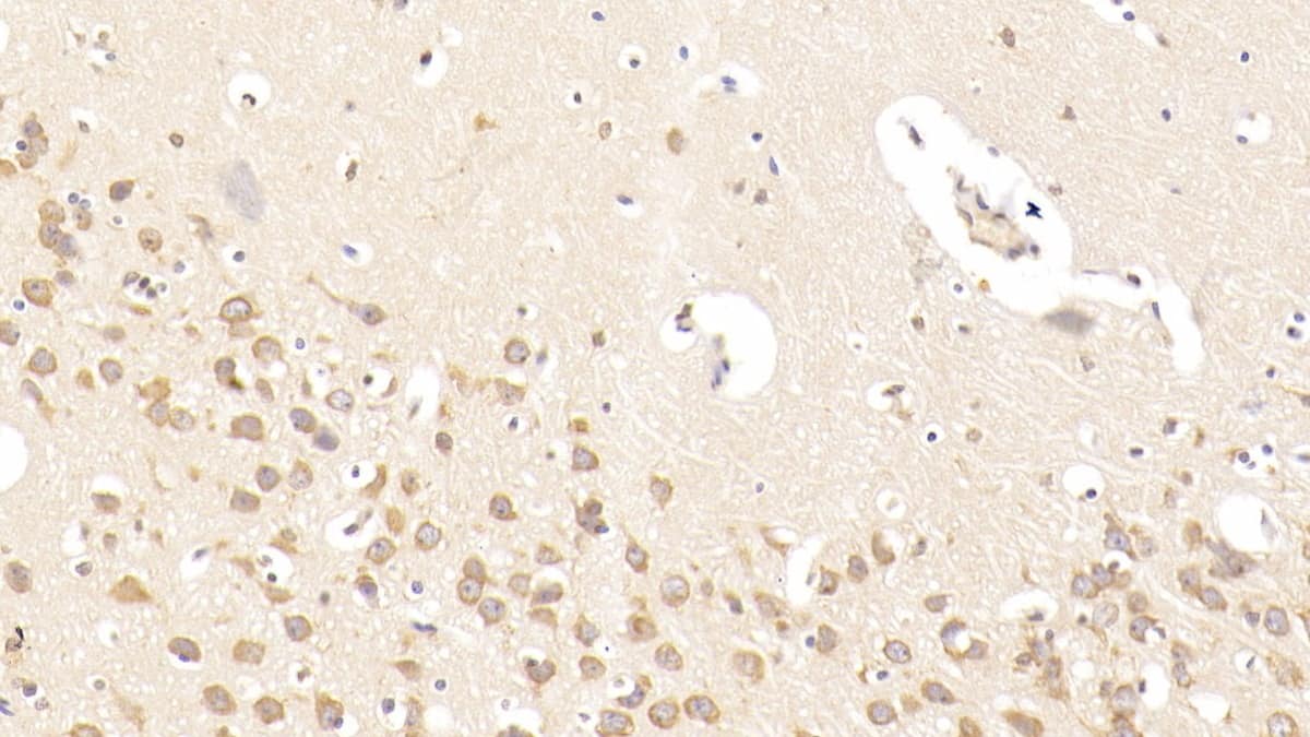 Immunohistochemistry-Paraffin: NMDA R, NR2B Subunit Antibody (D6) [NBP3-41886] - DAB staining on IHC-P; Sample: Human Cerebrum Tissue; Primary Ab: 30ug/ml NBP3-41886; Second Ab: 2ug/mL HRP-Linked Caprine Anti-Mouse IgG Polyclonal Antibody