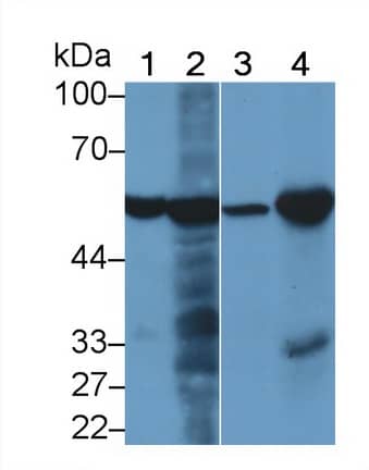 Western Blot: Phenylalanine Hydroxylase Antibody (C4) [NBP3-41889] - Sample: Lane1: Human Serum; Lane2: Rat Liver lysate; Lane3: Mouse Gallbladder lysate; Lane4: Hela cell lysate Primary Ab: 2ug/ml NBP3-41889; Second Ab: 0.2ug/mL HRP-Linked Caprine Anti-Mouse IgG Polyclonal Antibody