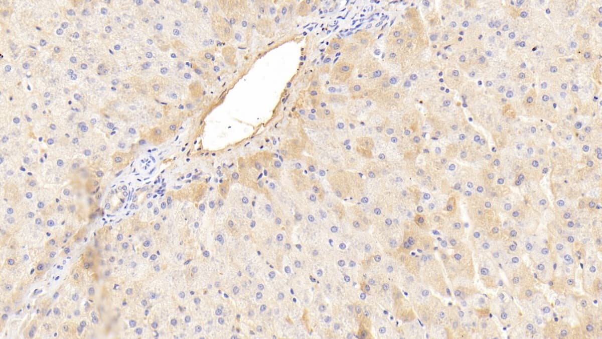 Immunohistochemistry-Paraffin: Phenylalanine Hydroxylase Antibody (C4) [NBP3-41889] - DAB staining on IHC-P; Sample: Human Liver Tissue; Primary Ab: 30ug/ml NBP3-41889; Second Ab: 2ug/mL HRP-Linked Caprine Anti-Mouse IgG Polyclonal Antibody