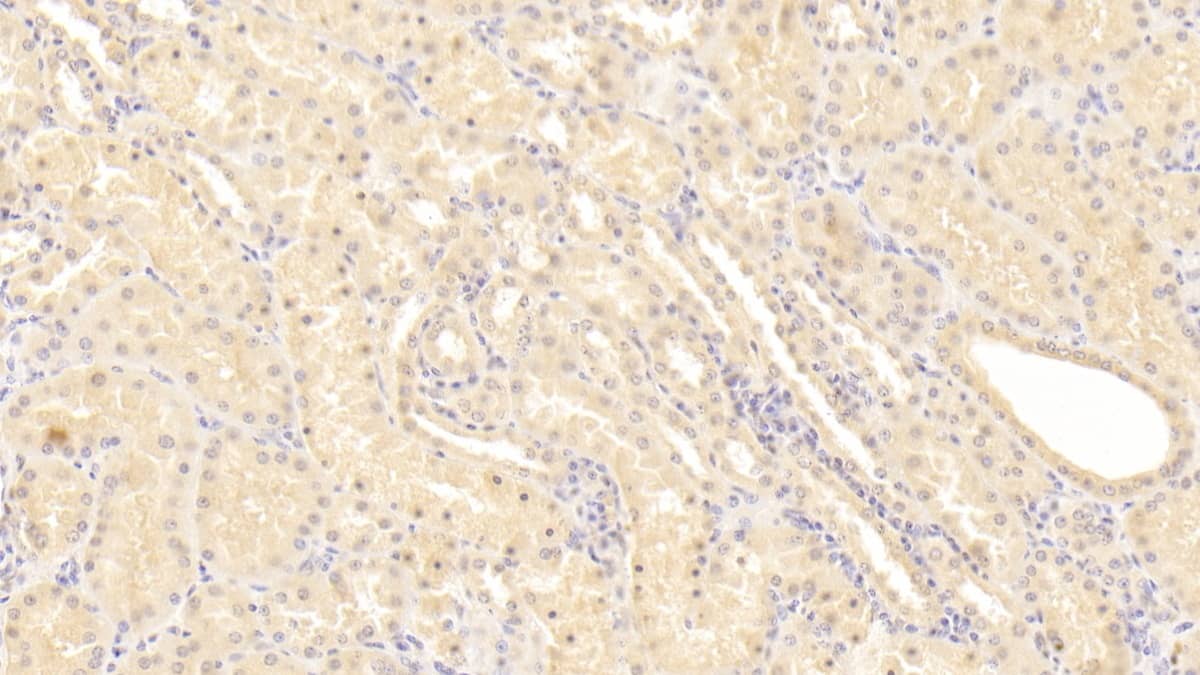 Immunohistochemistry-Paraffin: Phenylalanine Hydroxylase Antibody (C11) [NBP3-41890] - DAB staining on IHC-P; Sample: Human Kidney Tissue; Primary Ab: 20ug/ml NBP3-41890; Second Ab: 2ug/mL HRP-Linked Caprine Anti-Mouse IgG Polyclonal Antibody