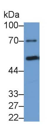 Western Blot: Phenylalanine Hydroxylase Antibody (C11) [NBP3-41890] - Sample: Human Serum Primary Ab: 2ug/ml NBP3-41890; Second Ab: 0.2ug/mL HRP-Linked Caprine Anti-Mouse IgG Polyclonal Antibody