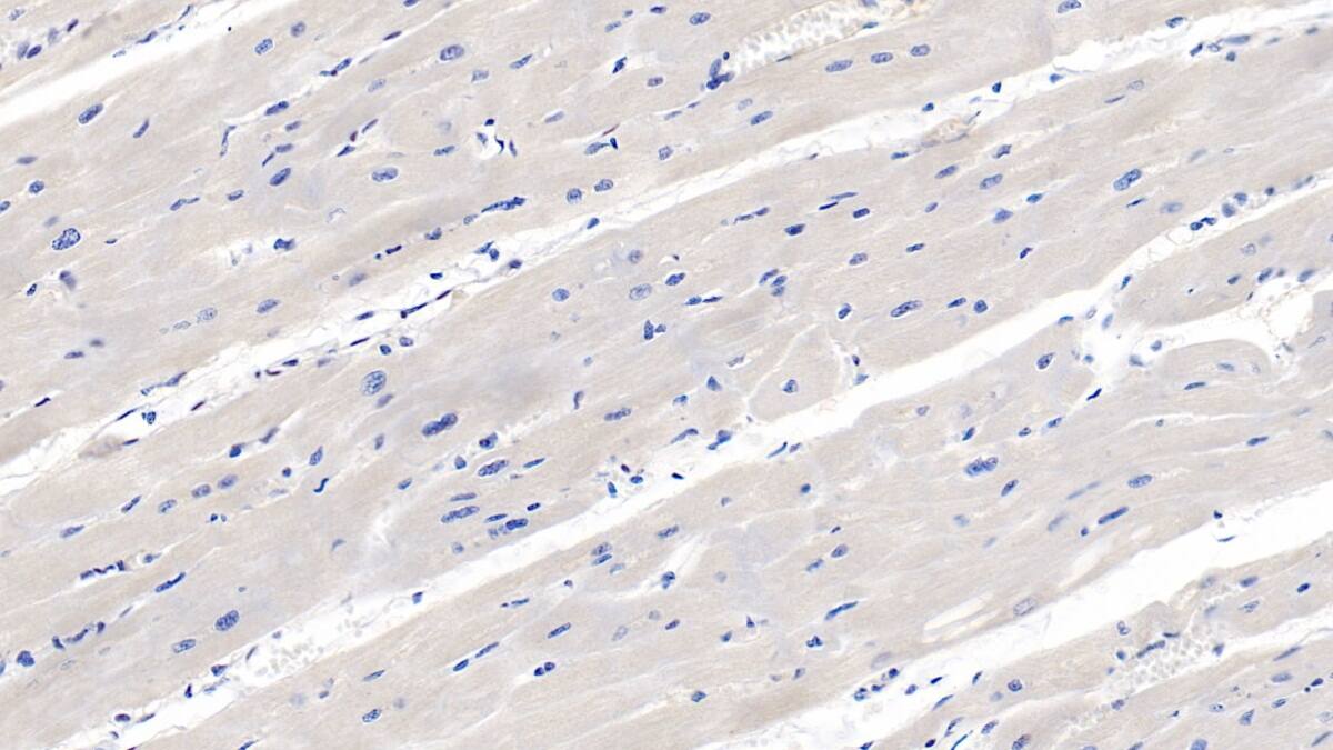 Immunohistochemistry-Paraffin: Renalase Antibody (C6) [NBP3-41891] - DAB staining on IHC-P; Sample: Human Cardiac Muscle Tissue; Primary Ab: 20ug/ml NBP3-41891; Second Ab: 2ug/mL HRP-Linked Caprine Anti-Mouse IgG Polyclonal Antibody