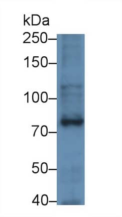 Western Blot: SLC6A4/5-HTTLPR/Serotonin transporter Antibody (C1) [NBP3-41892] - Sample: Human Placenta lysate Primary Ab: 3ug/ml NBP3-41892; Second Ab: 0.2ug/mL HRP-Linked Caprine Anti-Mouse IgG Polyclonal Antibody