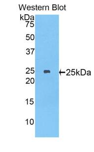 Western Blot: MYH8 Antibody [NBP3-41893] - Sample: Recombinant protein.