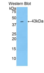 Western Blot LCN9 Antibody