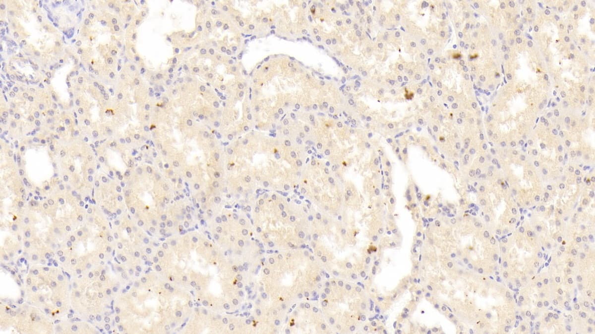 Immunohistochemistry-Paraffin: RIPK1/RIP1 Antibody (C4) [NBP3-41895] - DAB staining on IHC-P; Sample: Human Kidney Tissue; Primary Ab: 30ug/ml NBP3-41895; Second Ab: 2ug/mL HRP-Linked Caprine Anti-Mouse IgG Polyclonal Antibody