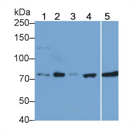 Western Blot: RIPK1/RIP1 Antibody (C4) [NBP3-41895] - Sample: Lane1: K562 cell lysate; Lane2: A549 cell lysate; Lane3: HepG2 cell lysate; Lane4: Raji cell lysate; Lane5: Human Serum Primary Ab: 1.5ug/ml NBP3-41895; Second Ab: 0.2ug/mL HRP-Linked Caprine Anti-Mouse IgG Polyclonal Antibody