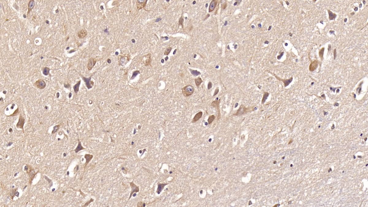 Immunohistochemistry-Paraffin: DCLK1 Antibody (C9) [NBP3-41896] - DAB staining on IHC-P; Sample: Human Cerebrum Tissue; Primary Ab: 20ug/ml NBP3-41896; Second Ab: 2ug/mL HRP-Linked Caprine Anti-Mouse IgG Polyclonal Antibody