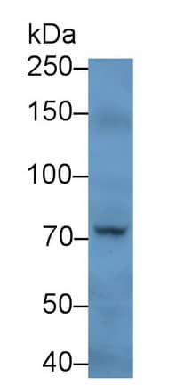 Western Blot: PADI4 Antibody (C4) [NBP3-41897] - Sample: Human Saliva Primary Ab: 3ug/ml NBP3-41897; Second Ab: 0.2ug/mL HRP-Linked Caprine Anti-Mouse IgG Polyclonal Antibody