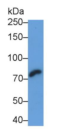 Western Blot: PADI4 Antibody (C12) [NBP3-41898] - Sample: Human Saliva Primary Ab: 2ug/ml NBP3-41898; Second Ab: 0.2ug/mL HRP-Linked Caprine Anti-Mouse IgG Polyclonal Antibody