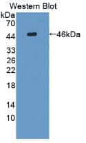 Western Blot: IL-31 Antibody (A3) [NBP3-41902] - Sample: Recombinant IL-31, Rat.